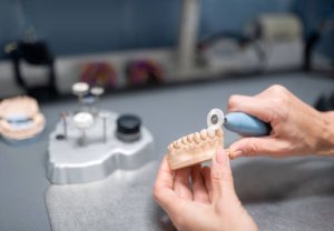 Combien Coûte une Prothèse Dentaire au Québec ? Prix et Types de Prothèses