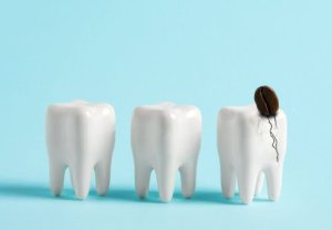 Combien coûte une urgence dentaire au Québec ?
