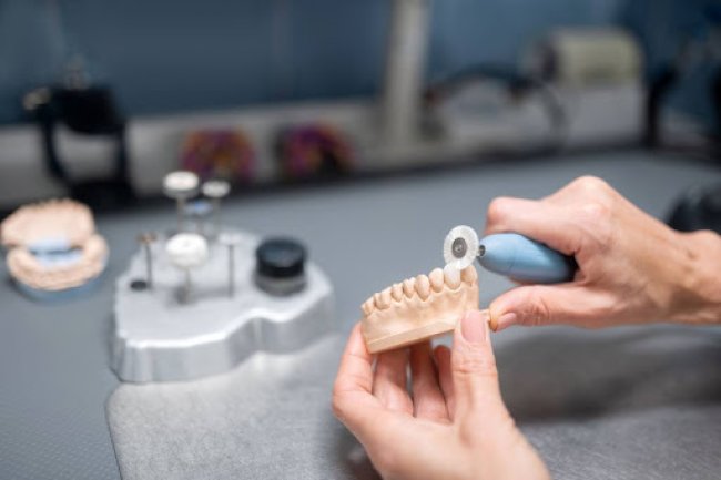 Combien Coûte une Prothèse Dentaire au Québec ? Prix et Types de Prothèses